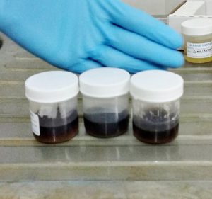 3 urine pots that are now black due to AKU. Service with medical genetics at CMC Vellore